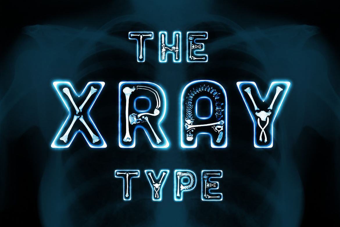 The Xray Font Deeezy
