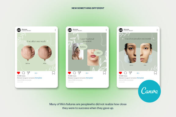 Skincare Instagram | CANVA Template