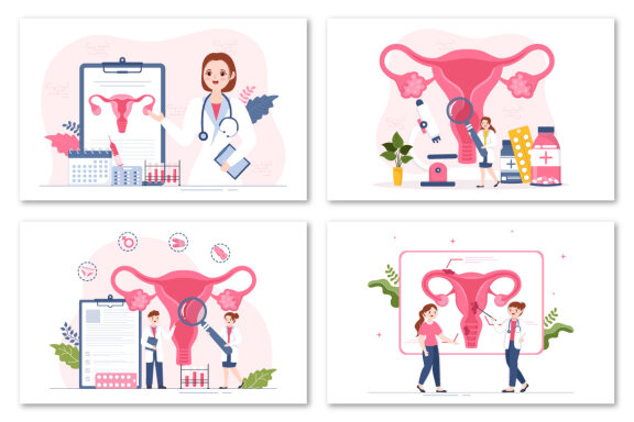 13 Endometriosis Illustration
