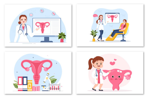 13 Endometriosis Illustration