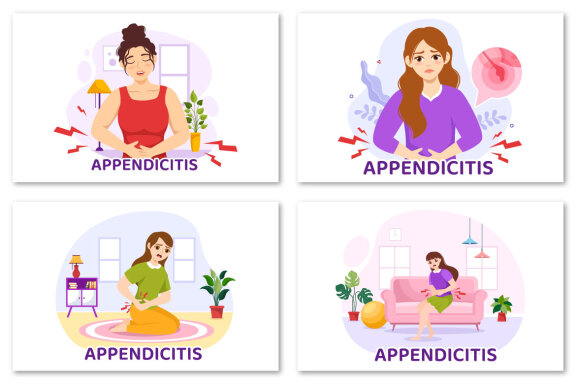 12 Appendicitis Inflammation Illustration