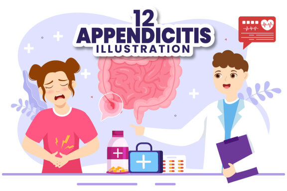 12 Appendicitis Inflammation Illustration