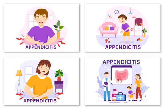 12 Appendicitis Inflammation Illustration