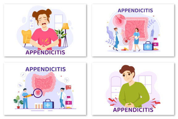 12 Appendicitis Inflammation Illustration