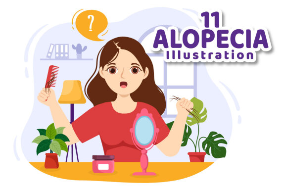 11 Alopecia Hair Loss Illustration