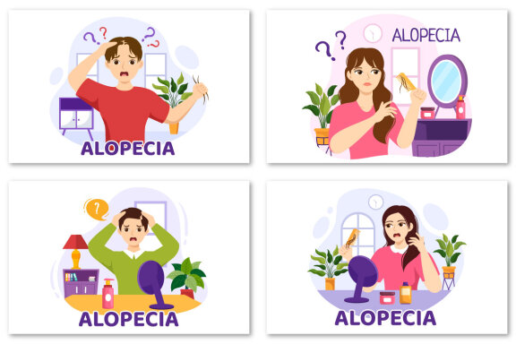 11 Alopecia Hair Loss Illustration