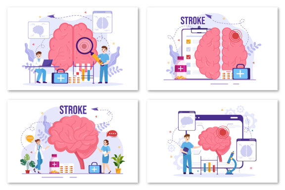 12 Human Brain Stroke Illustration