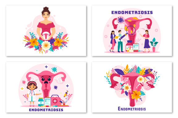 12 Endometriosis Illustration
