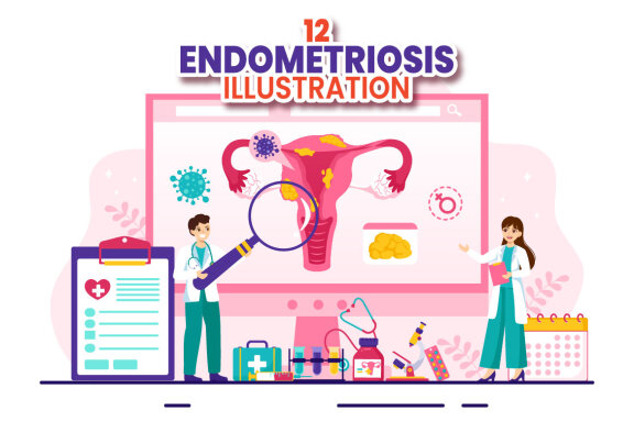 12 Endometriosis Illustration