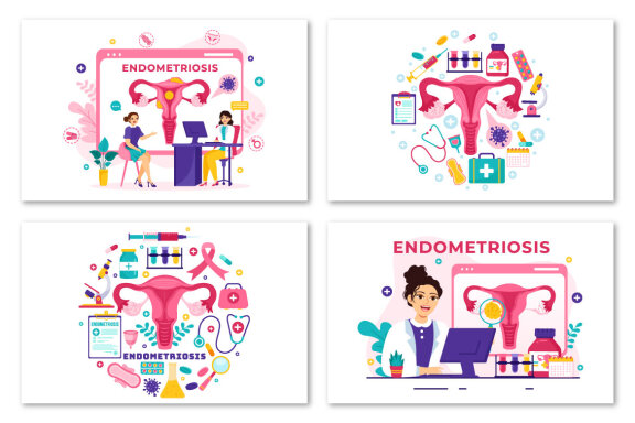 12 Endometriosis Illustration