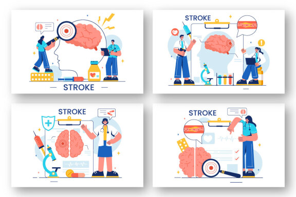 12 Human Brain Stroke Illustration