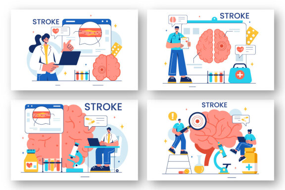 12 Human Brain Stroke Illustration