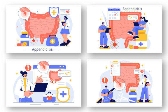 9 Appendicitis Inflammation Illustration