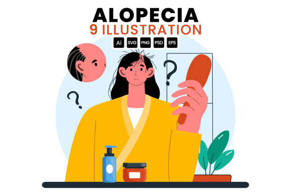 9 Alopecia Hair Loss Illustration